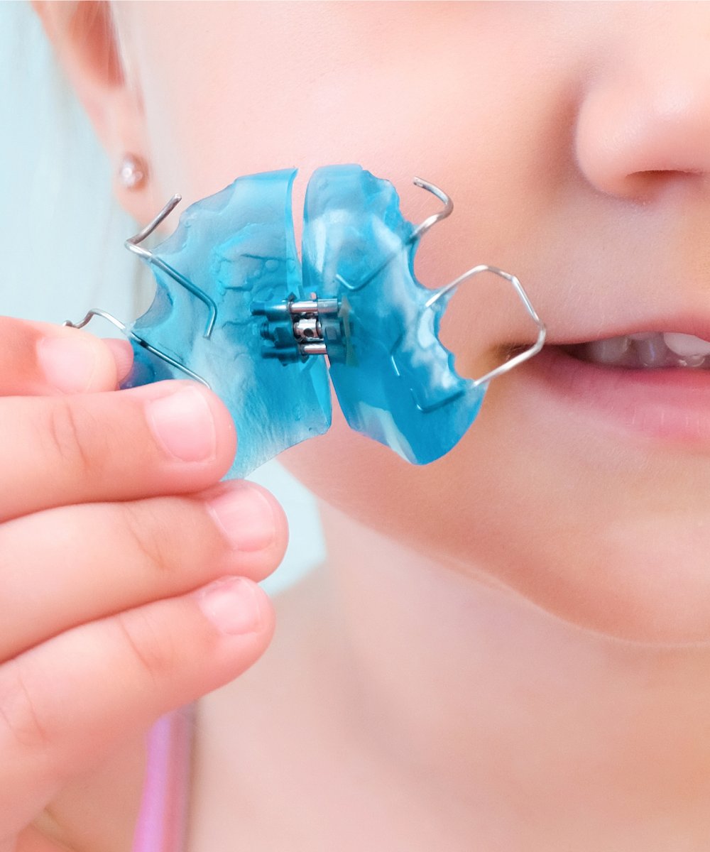 Bambina che tiene apparecchio mobile per ortodonzia intercettiva